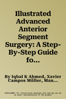 Illustrated Advanced Anterior Segment Surgery: A Step-By-Step Guide for Challenging Cases