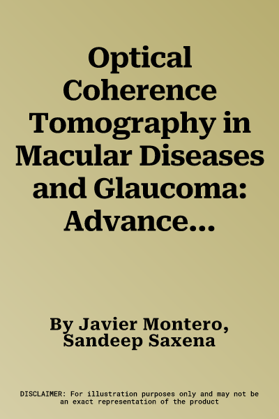 Optical Coherence Tomography in Macular Diseases and Glaucoma: Advanced Knowledge