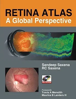 Retina Atlas: A Global Perspective