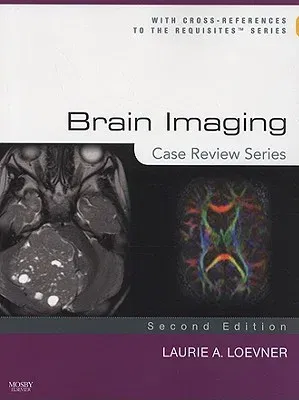 Brain Imaging: Case Review Series