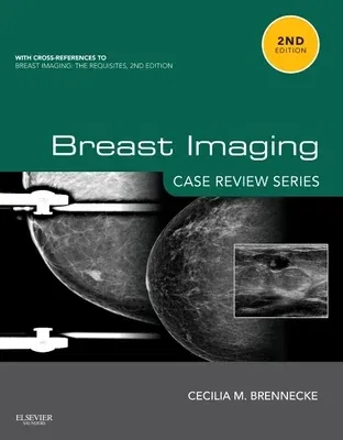 Breast Imaging: Case Review Series (Revised)