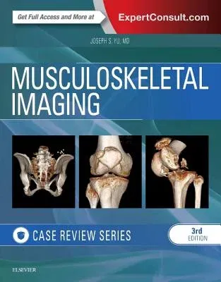 Musculoskeletal Imaging