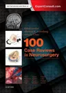 100 Case Reviews in Neurosurgery