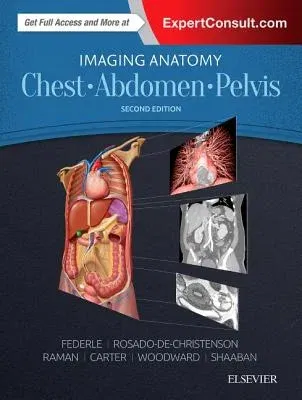 Imaging Anatomy: Chest, Abdomen, Pelvis