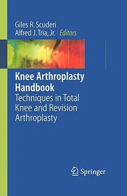 Knee Arthroplasty Handbook: Techniques in Total Knee and Revision Arthroplasty (2006)