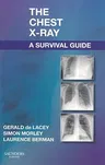 The Chest X-Ray: A Survival Guide