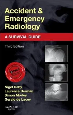 Accident and Emergency Radiology: A Survival Guide (Revised)