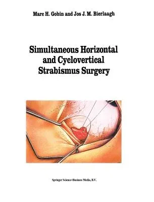 Simultaneous Horizontal and Cyclovertical Strabismus Surgery (1994)