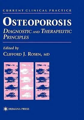 Osteoporosis: Diagnostic and Therapeutic Principles (1996)