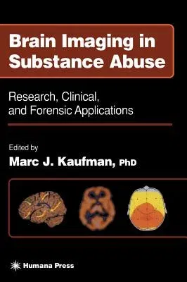 Brain Imaging in Substance Abuse: Research, Clinical, and Forensic Applications (2001)