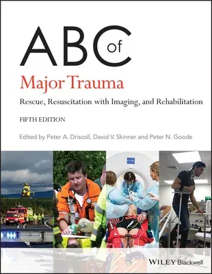 ABC of Major Trauma: Rescue, Resuscitation with Imaging, and Rehabilitation