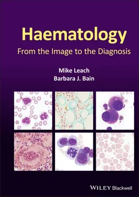 Haematology: From the Image to the Diagnosis