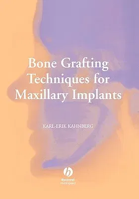 Bone Graft Maxil Implants