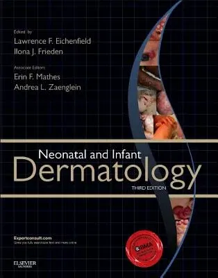 Neonatal and Infant Dermatology (Revised)