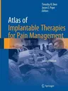 Atlas of Implantable Therapies for Pain Management (Softcover Reprint of the Original 2nd 2016)