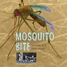 Mosquito Bite (Revised)