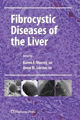 Fibrocystic Diseases of the Liver (2010)