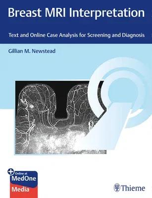 Breast MRI Interpretation: Text and Case Analysis for Screening and Diagnosis