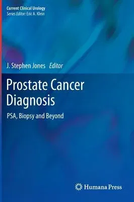 Prostate Cancer Diagnosis: Psa, Biopsy and Beyond (2013)