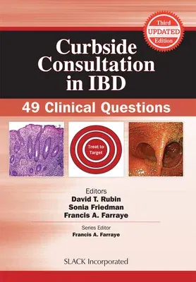 Curbside Consultation in Ibd: 49 Clinical Questions