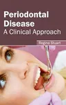 Periodontal Disease: A Clinical Approach