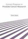 Current Progress in Prostate Cancer Research