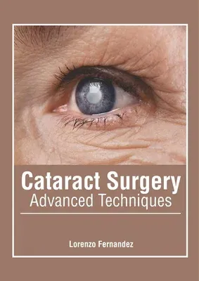 Cataract Surgery: Advanced Techniques