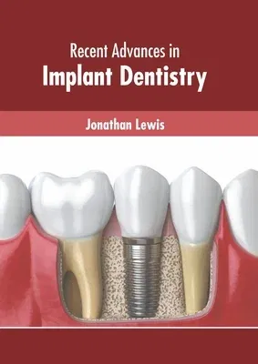 Recent Advances in Implant Dentistry