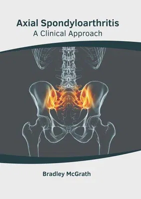 Axial Spondyloarthritis: A Clinical Approach