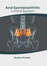 Axial Spondyloarthritis: A Clinical Approach