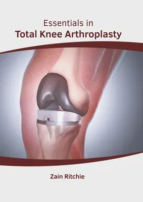 Essentials in Total Knee Arthroplasty