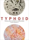 Typhoid: The Past, Present, and Future of an Ancient Disease