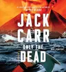 Only the Dead: A Thriller