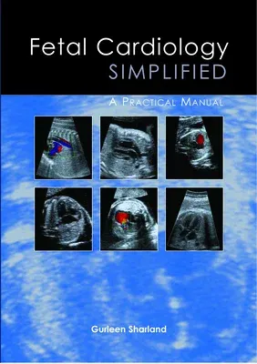 Fetal Cardiology Simplified: A Practical Manual