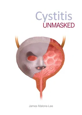 Cystitis Unmasked