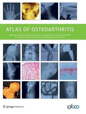 Atlas of Osteoarthritis (2014)