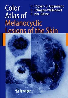 Color Atlas of Melanocytic Lesions of the Skin (2007)