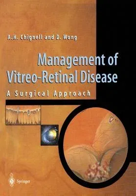 Management of Vitreo-Retinal Disease: A Surgical Approach (1999)