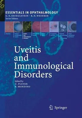 Uveitis and Immunological Disorders (2005)