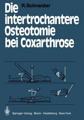 Die Intertrochantere Osteotomie Bei Coxarthrose (Softcover Reprint of the Original 1st 1979)