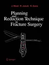 Planning and Reduction Technique in Fracture Surgery (Softcover Reprint of the Original 1st 1989)