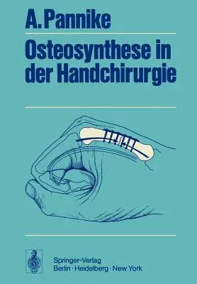 Osteosynthese in Der Handchirurgie (Softcover Reprint of the Original 1st 1972)