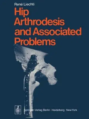 Hip Arthrodesis and Associated Problems (Softcover Reprint of the Original 1st 1978)