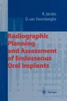 Radiographic Planning and Assessment of Endosseous Oral Implants (Softcover Reprint of the Original 1st 1998)