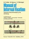 Manual of Internal Fixation: Technique Recommended by the Ao-Group Swiss Association for the Study of Internal Fixation: Asif (Softcover Reprint of th