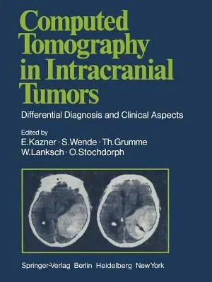 Computed Tomography in Intracranial Tumors: Differential Diagnosis and Clinical Aspects (1981)