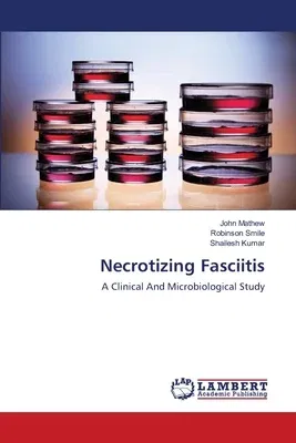 Necrotizing Fasciitis