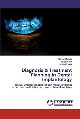 Diagnosis & Treatment Planning in Dental Implantology