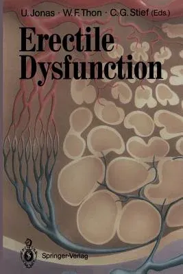 Erectile Dysfunction (Softcover Reprint of the Original 1st 1991)