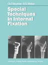 Special Techniques in Internal Fixation (Softcover Reprint of the Original 1st 1982)